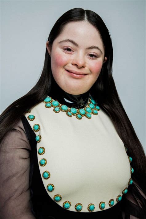gucci down syndrome model